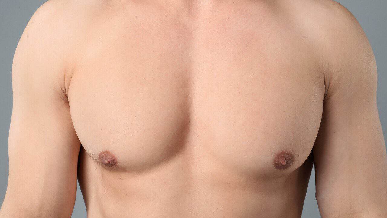 revision gynecomastia